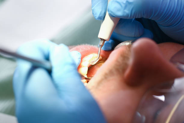 Best Tooth Pain Emergency Relief  in North Edwards, CA