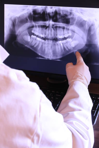 Best Root Canal Emergency Dentist  in North Edwards, CA