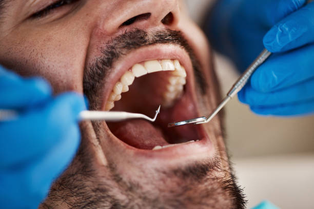 Best Emergency Gum Pain Relief  in North Edwards, CA
